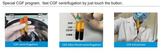 PRP Centrifuge Machine TD4 with 4000 RPM Speed 1980xg RCF and 8x15ml Rotor Capacity